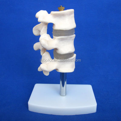 Modelli educativi avanzati di PVC Cutaway Osteoporosi della colonna vertebrale Lesioni della vertebra lombare