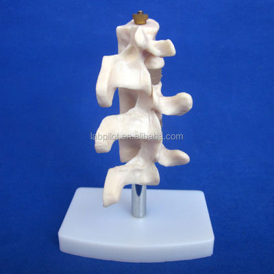 Modelli educativi avanzati di PVC Cutaway Osteoporosi della colonna vertebrale Lesioni della vertebra lombare