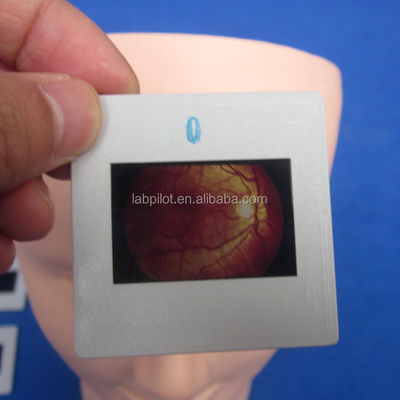 Manichino per l'esame dell'occhio umano avanzato Simulatore di addestramento per la retinopatia Modello di fondo