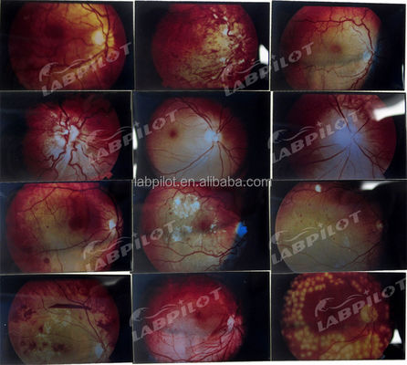 Manichino per l'esame dell'occhio umano avanzato Simulatore di addestramento per la retinopatia Modello di fondo