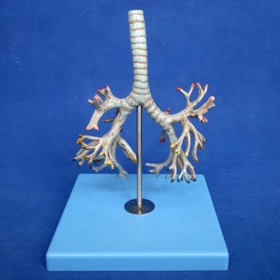 Vivido albero bronchiale anatomico modello 26 posizioni segnate anatomia della trachea per la scienza medica