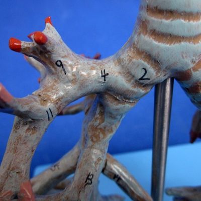 Vivido albero bronchiale anatomico modello 26 posizioni segnate anatomia della trachea per la scienza medica