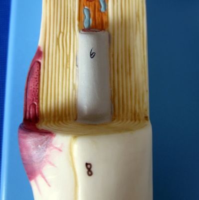 Modello anatomico avanzato in PVC del corpo delle cellule neuronali ingrandite e della struttura delle fibre nervose