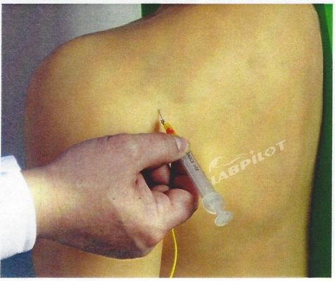 Soggetto Scienze mediche manichino elettronica spalla articolare iniezione addestramento simulatore Modello infermieristico