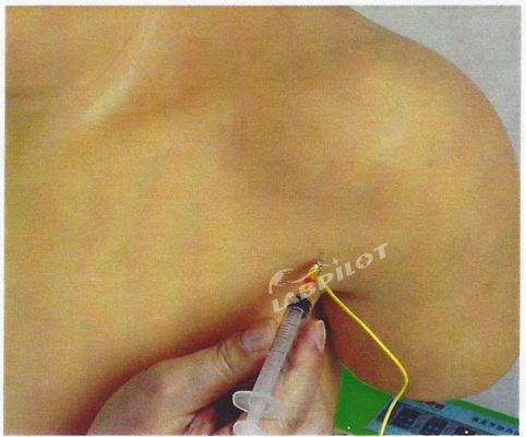 Formazione medica avanzata in PVC Modello didattico di simulazione di iniezione intracavitale della spalla
