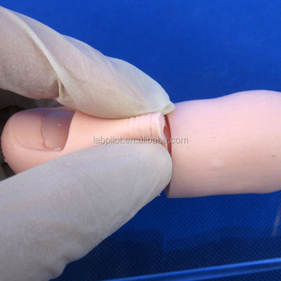 Modello di addestramento all'escissione delle unghie per l'insegnamento delle competenze chirurgiche cliniche in scienze mediche