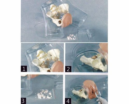 Modello di ostetricia-ginecologia Simulatore di curettage uterino trasparente per scuola infermieristica