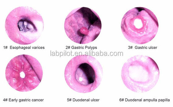 Esame gastroscopico avanzato e modello di formazione ERCP per le lesioni gastrointestinali