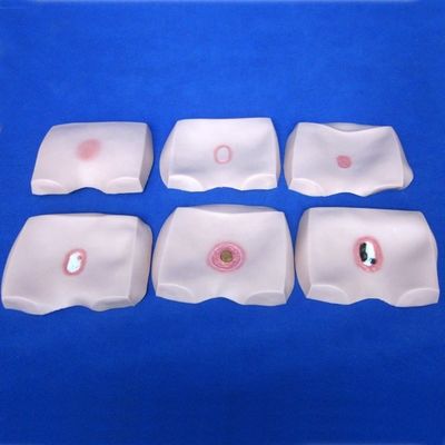 Modelli di formazione infermieristica clinica Stadi di decubito ulcera Cura infermieristica per ospedali