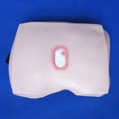 Modelli di formazione infermieristica clinica Stadi di decubito ulcera Cura infermieristica per ospedali