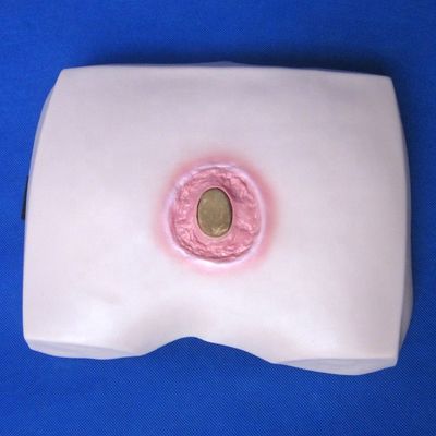 Modelli di formazione infermieristica clinica Stadi di decubito ulcera Cura infermieristica per ospedali