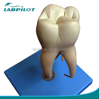 Modello di denti anatomici staccabili per denti molari a tre radici
