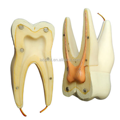Modello di denti anatomici staccabili per denti molari a tre radici