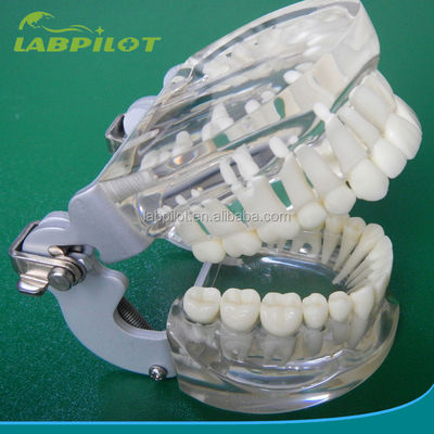 Modelli di formazione per l'odontoiatria Trasparenti per adulti Standard Modello di colonna dentale Dimensioni standard
