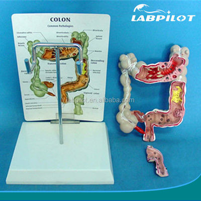 Modelli oftalmologici e anatomici Modello intestinale umano per le malattie del colon e del retto