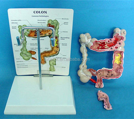 Modelli oftalmologici e anatomici Modello intestinale umano per le malattie del colon e del retto