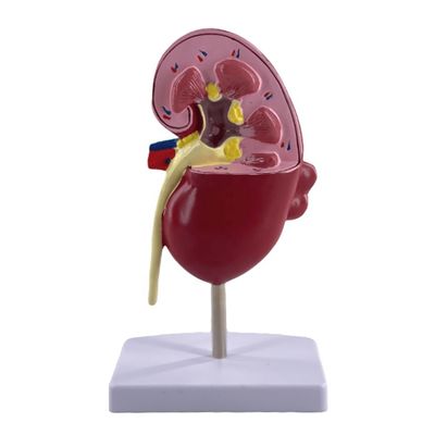 Modello del rene patologico PVC per scuole di medicina e ospedali di urologia