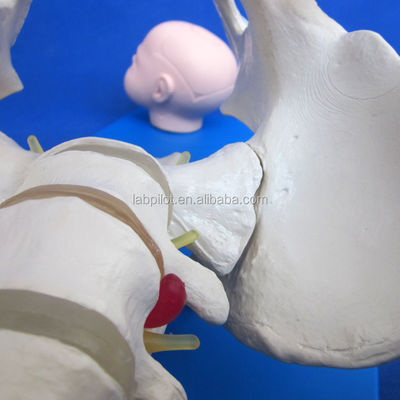 Pelvis e teste fetali vivi Modello avanzato in PVC per la dimostrazione delle abilità di parto