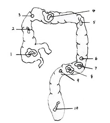 Modello di anatomia del retto e del colon Simulatore di endoscopia intestinale in PVC avanzato