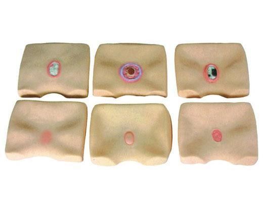 Simulatore di ulcere per ospedali Migliorare la formazione infermieristica sul mal di letto