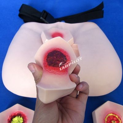 Modello di cura del paziente Dimostrazione di pressione Ulcere Infermieristica Modello di insegnamento