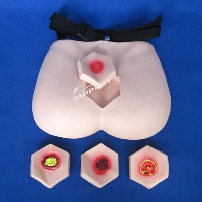 Modello di cura del paziente Dimostrazione di pressione Ulcere Infermieristica Modello di insegnamento