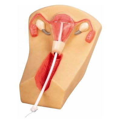 Lo IUD in PVC è uno strumento ideale per insegnare la pianificazione familiare