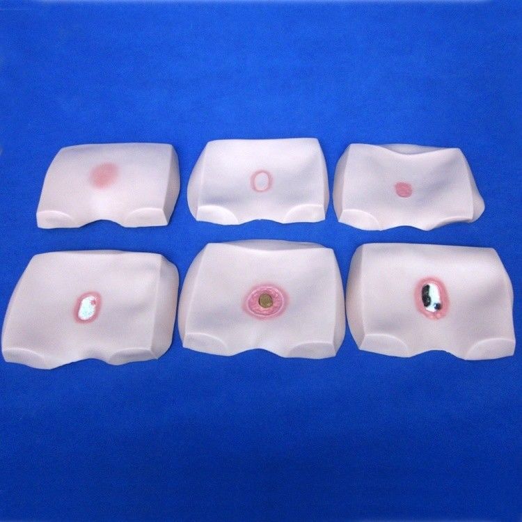 Modelli di formazione infermieristica clinica Stadi di decubito ulcera Cura infermieristica per ospedali