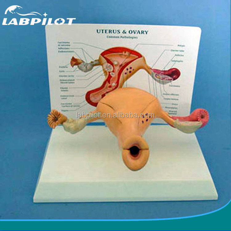 Modello avanzato dell'utero e dell'ovaio umano in PVC per l'educazione del sistema riproduttivo femminile